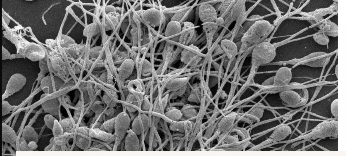 Bringing Male Fertility out of the Shadows