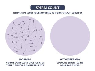azoospermia